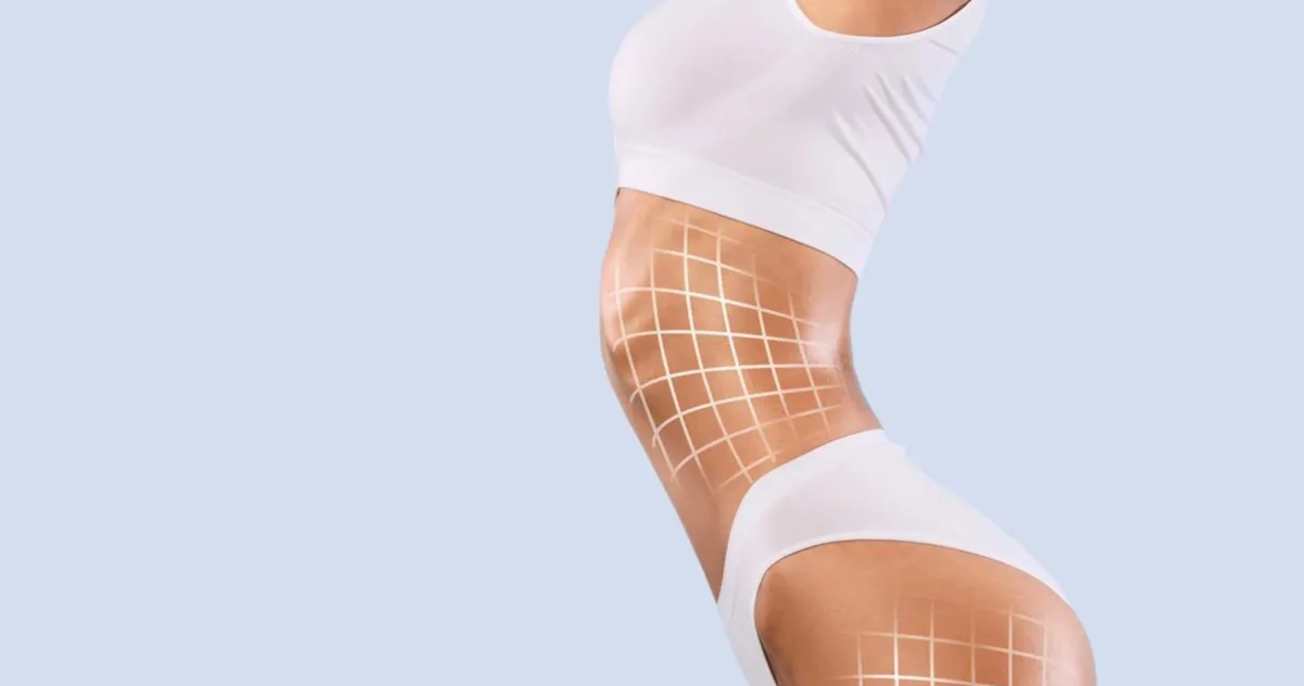 Imagem destacada - Tecnologias como radiofrequência impulsionam evolução da lipoaspiração no Brasil